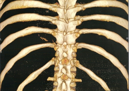 CT 3D