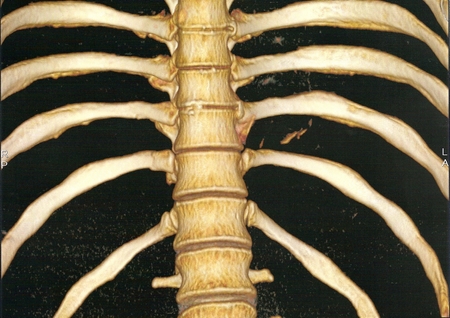 CT 3D 2