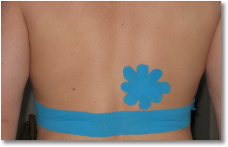 Kinesiotape Rippen 1