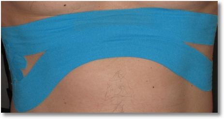 Kinesiotape Rippen 2
