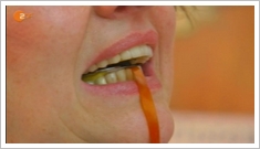 Richtiger Biss oder Myoarthropathie